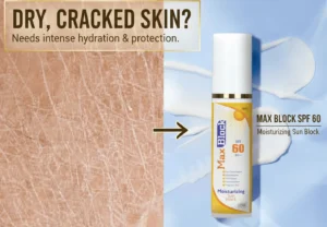 sunblock for dry skin