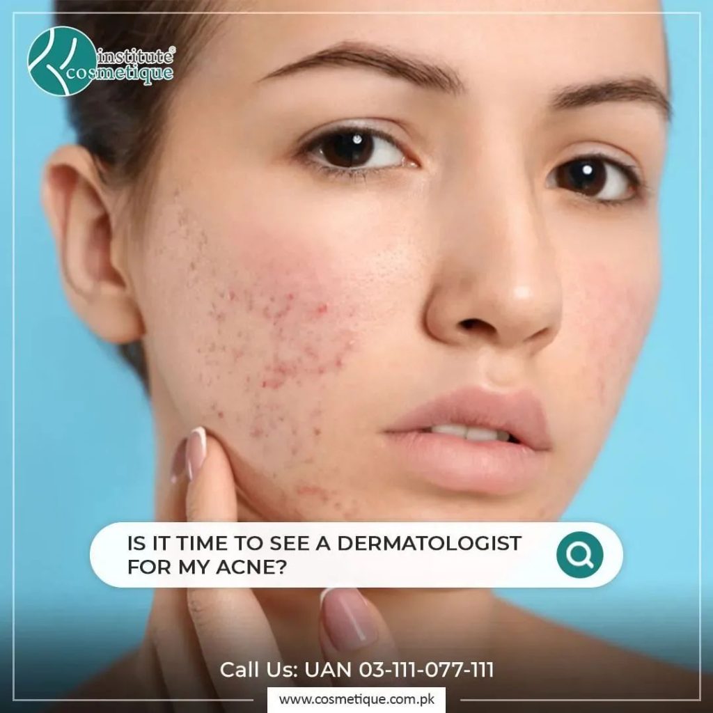 Can a Dermatologist Reduce Acne Marks and Improve Skin Appearance?