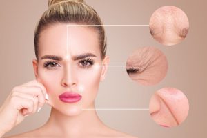 anti-aging-treatment